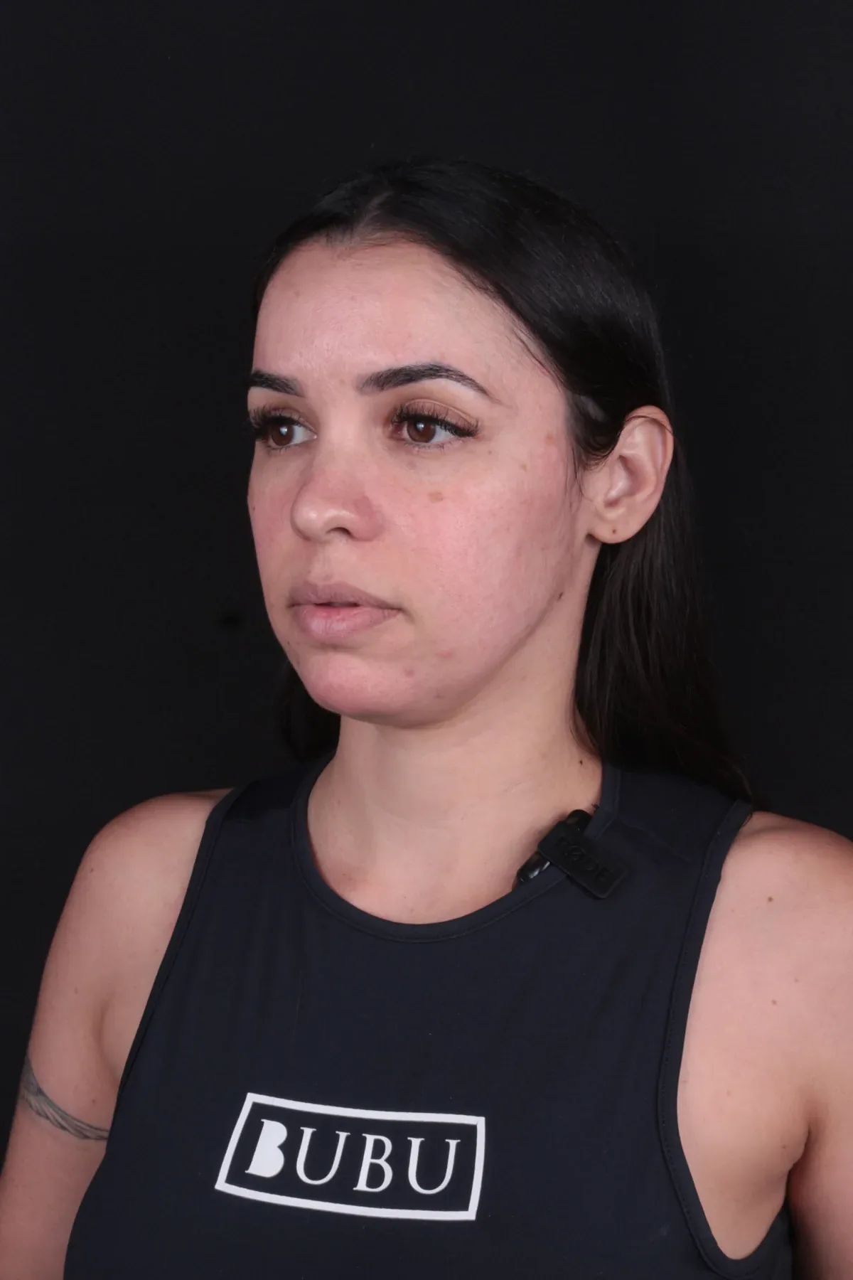 Caso 2, antes do procedimento
