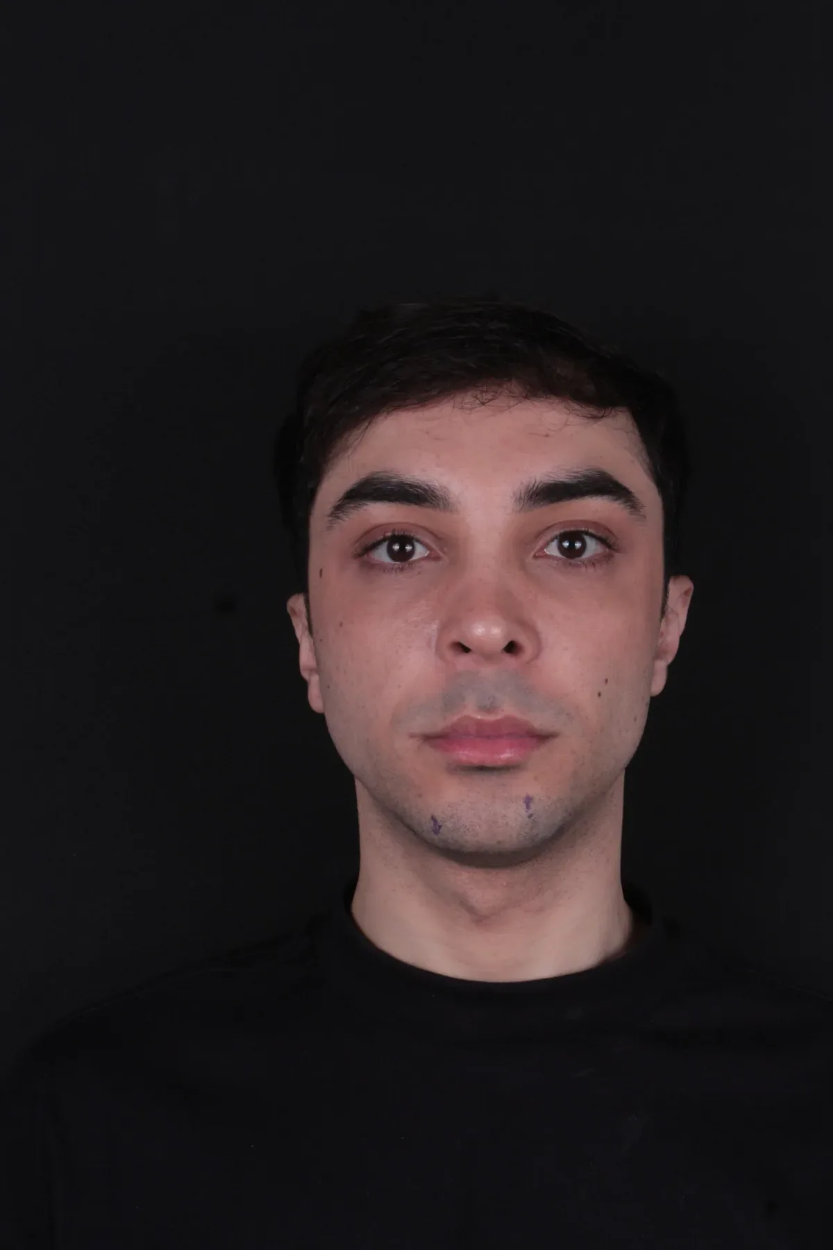 Caso 4, antes do procedimento