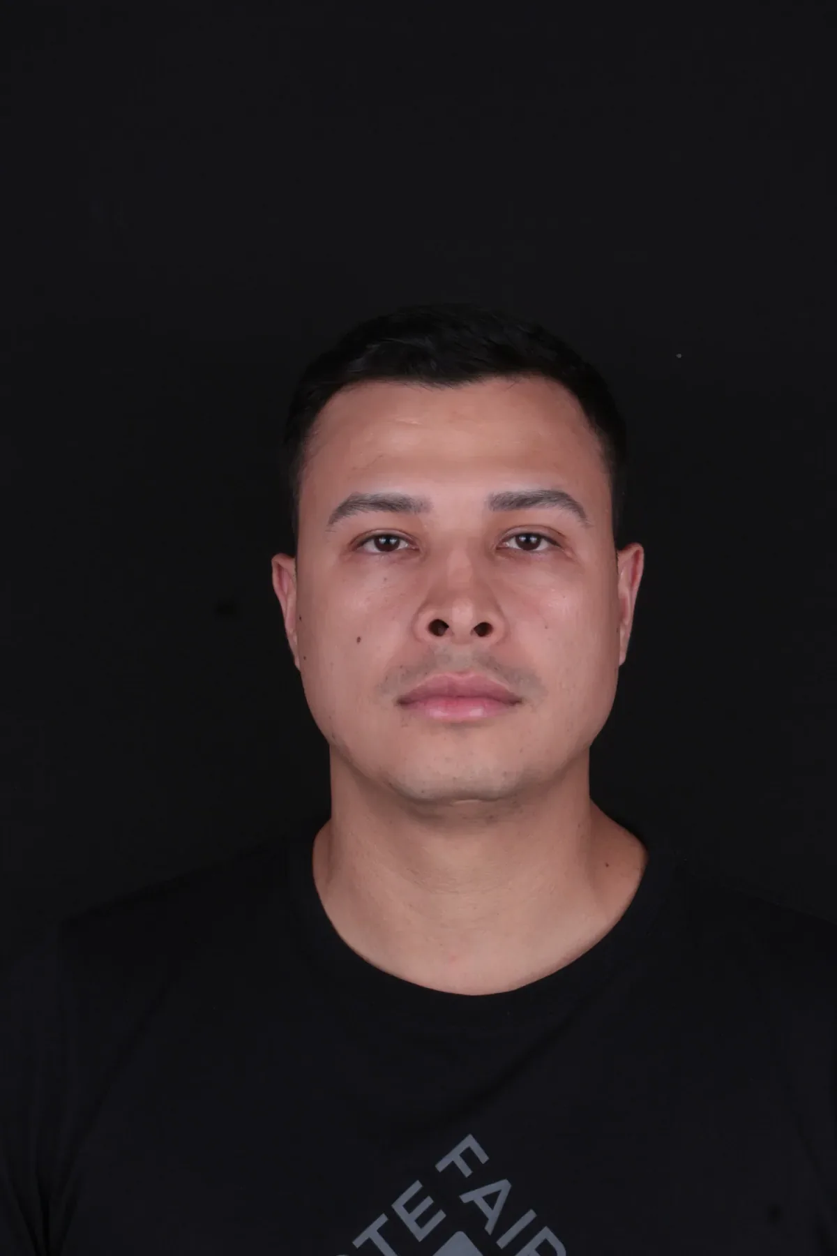 Caso 9, antes do procedimento